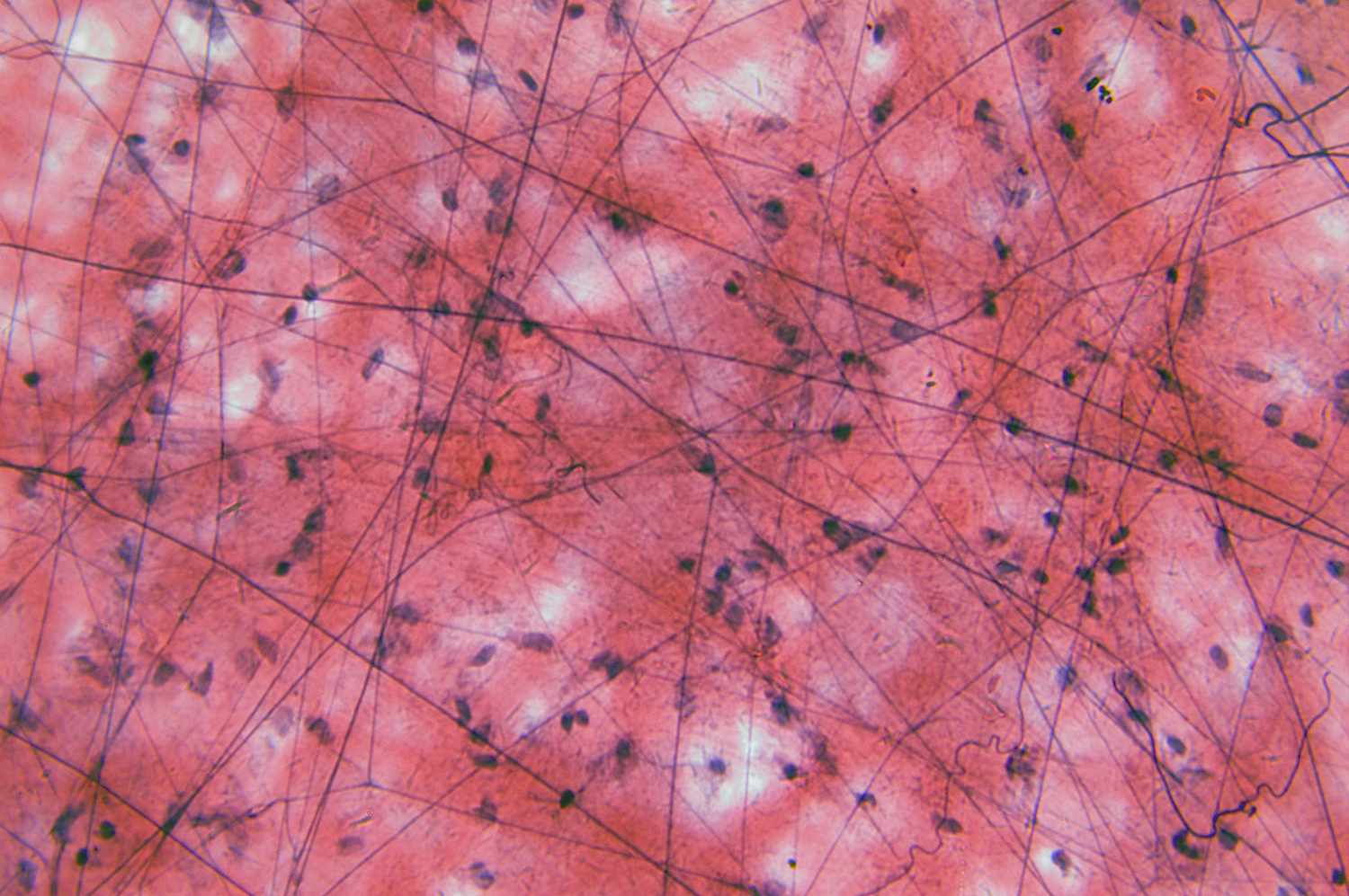 <p>binds and supports other tissues</p><p>1) has<em> many functions </em>(ex: cartilage connects muscles to bones.)</p><p>2) contain <strong>matrix </strong></p><p>3) there are <strong>fibrous </strong>and <strong>loose </strong>connective tissues</p>