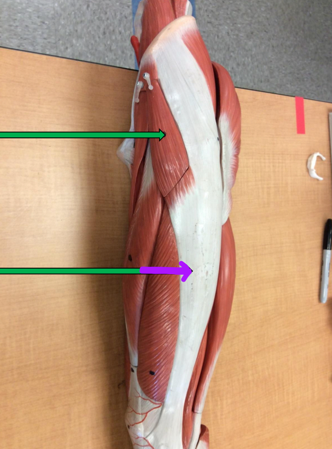 <p>Identify this muscle?</p>