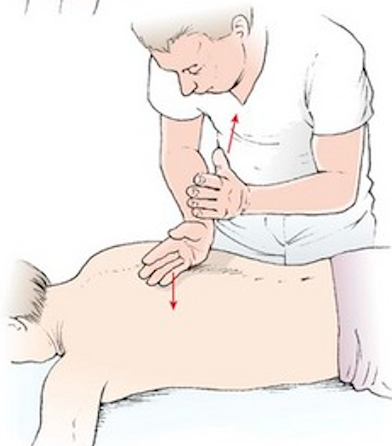 <p>Med ulnarsidan av handen slår fingertopparna på lill-, ring- och långfingret mot muskelbuken. Rörelsen ska komma från handleden.</p>
