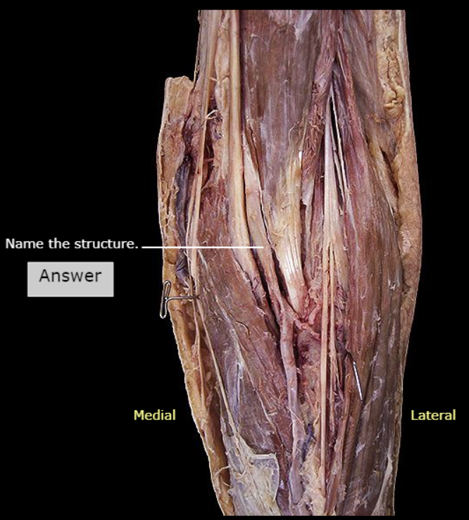 <p>What artery is this</p>