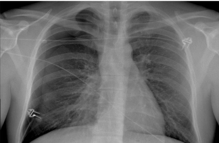 <p>What is this patient presenting with?</p>