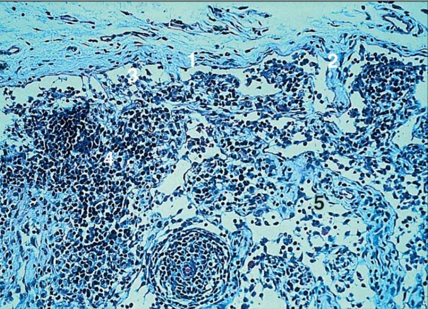 <p>lymph node, pig</p>