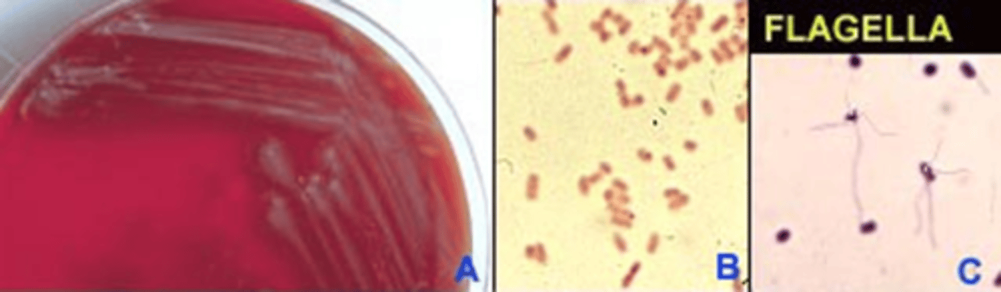 <p>Illustrated in the image to the left are 3-day old colonies growing on blood agar. The colonies are gray and spreading, and a sweet, fruity odor is noted. Plump, Gram-negative coccobacilli are seen on Gram stain. This isolate belongs to the motile, non-fermenters with peritrichous flagella. Carbohydrate utilization is asaccharolytic. Nitrite reduction produces gas and citrate is positive. From the multiple choices, select the name of this isolate.</p>