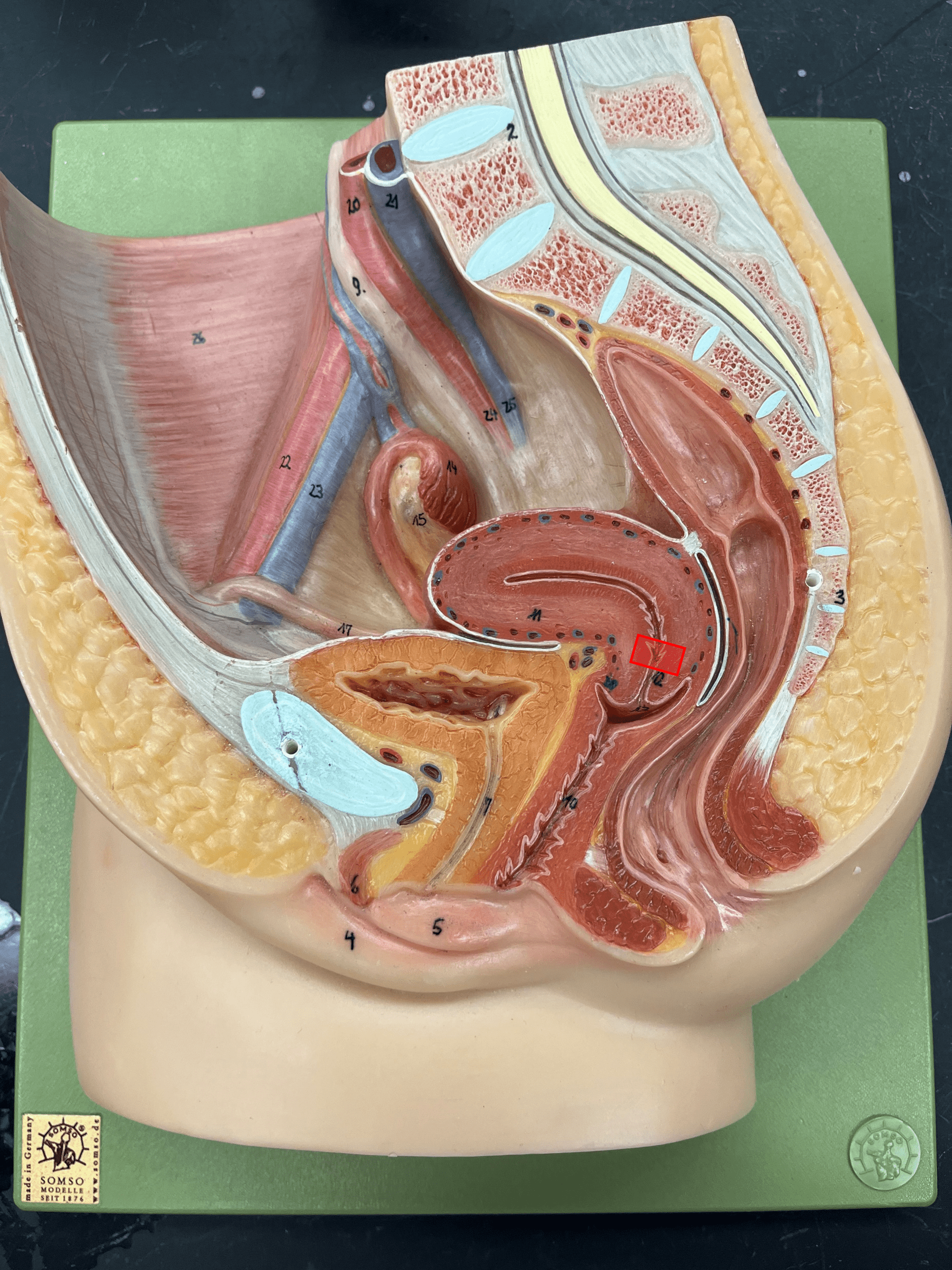 • A region of the cervix.

• The opening to the uterus from the cervical canal.