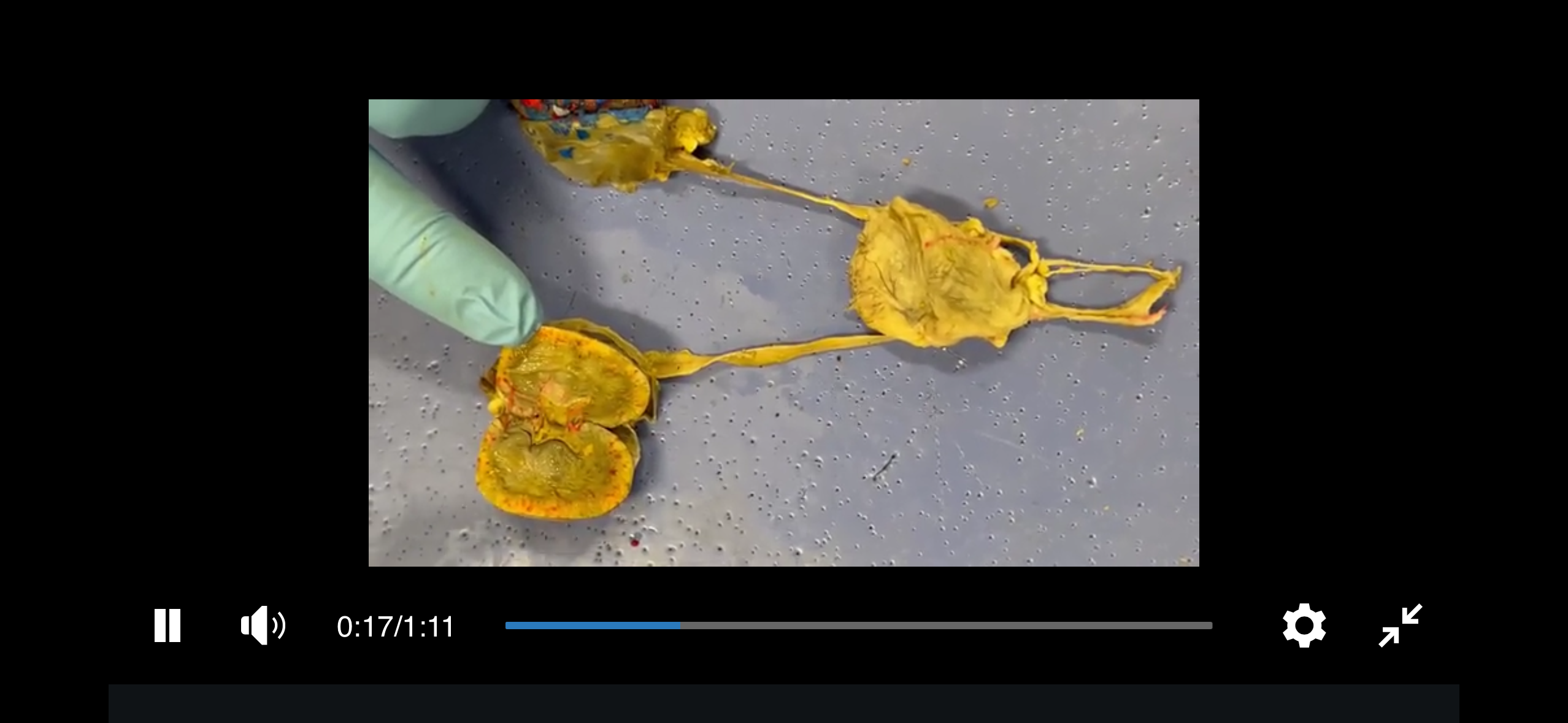 <p>Ureter</p>