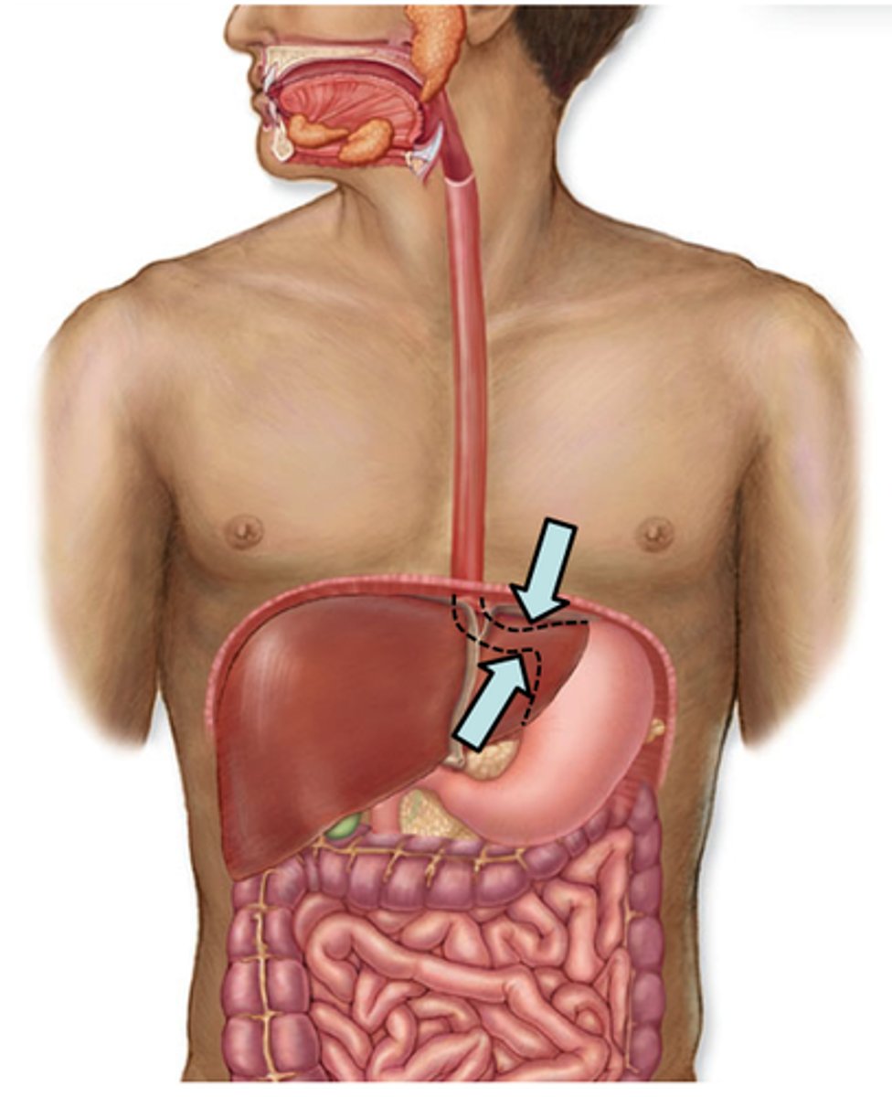 <p>what is the ring of muscle on the model</p>