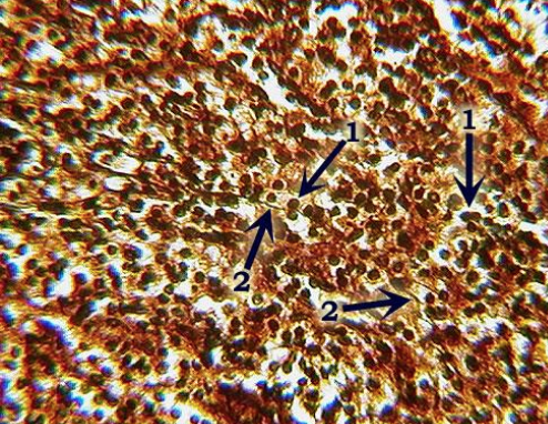 <p>reticular connective tissue</p>