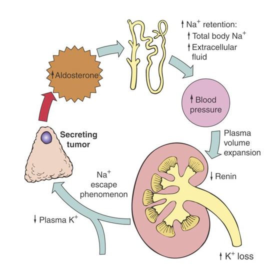 <p>AKA Primary Hyperaldosteronism</p><ul><li><p>As this condition of hyperaldosteronism from a tumor continues on, there’s Na Escape Phenomenon (Na levels are returned to the high end of the normal range). </p></li></ul><p></p>