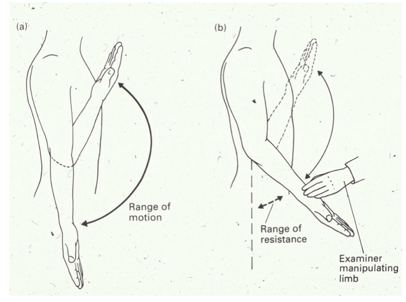 <p>what is Clasp knife reflex?</p>