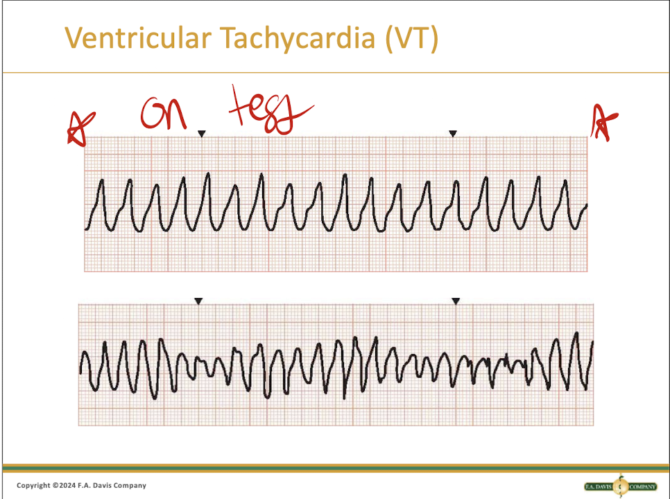 <p>It looks like a bunch of tombstones bc that is where you are going</p>