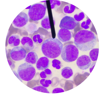 <p>what kind of white blood cells is this?</p>