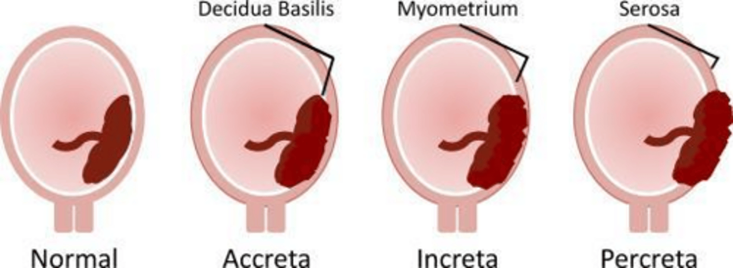 <p>Accreta (superficial), Increta (deep), Percreta (through uterine wall).</p>