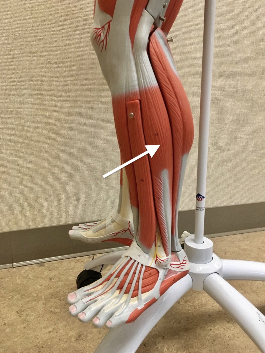 <p><span>Name the muscle labeled with the white arrow below:</span></p>