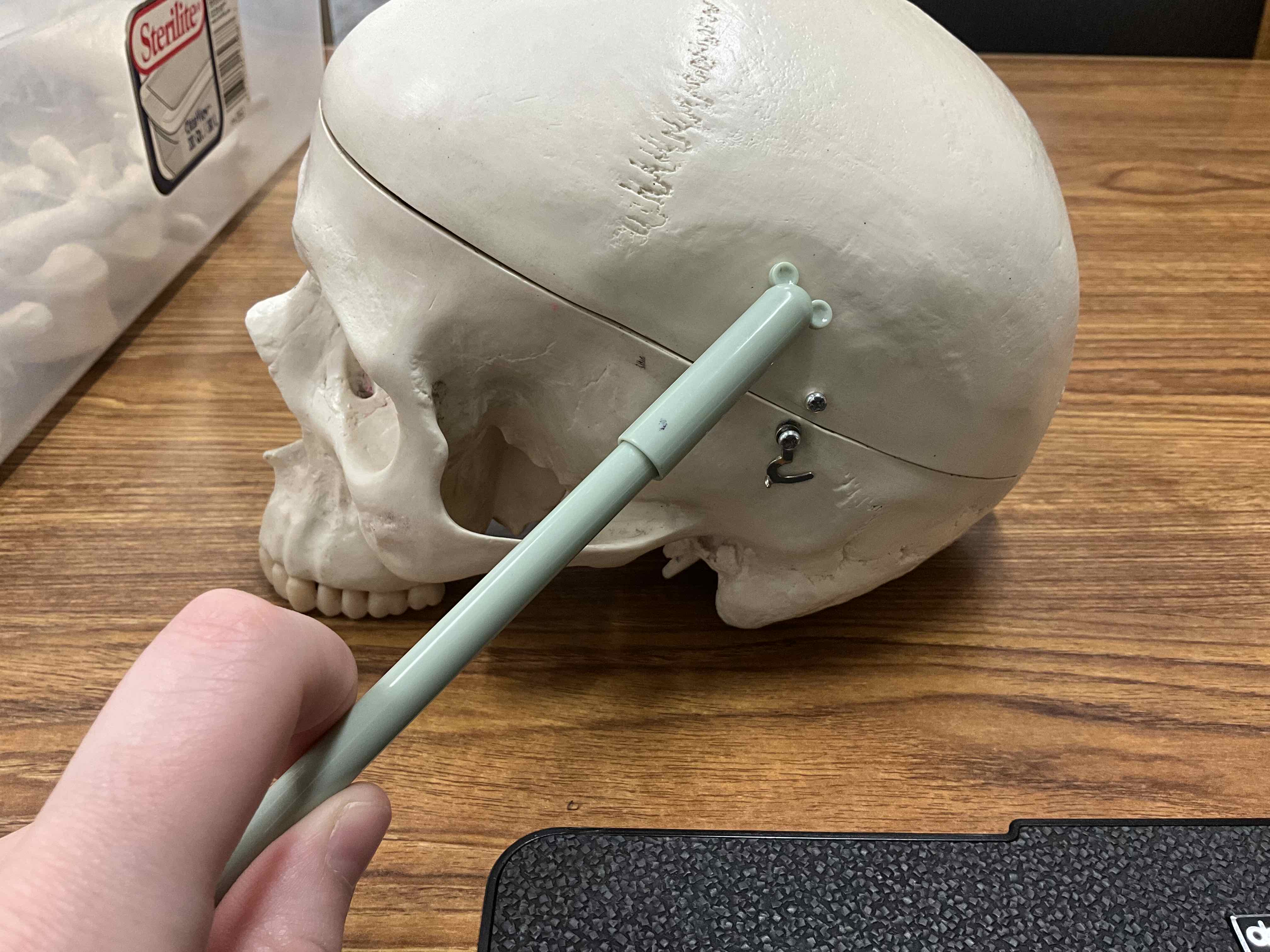 <p>Suture (hard to see on model)</p>
