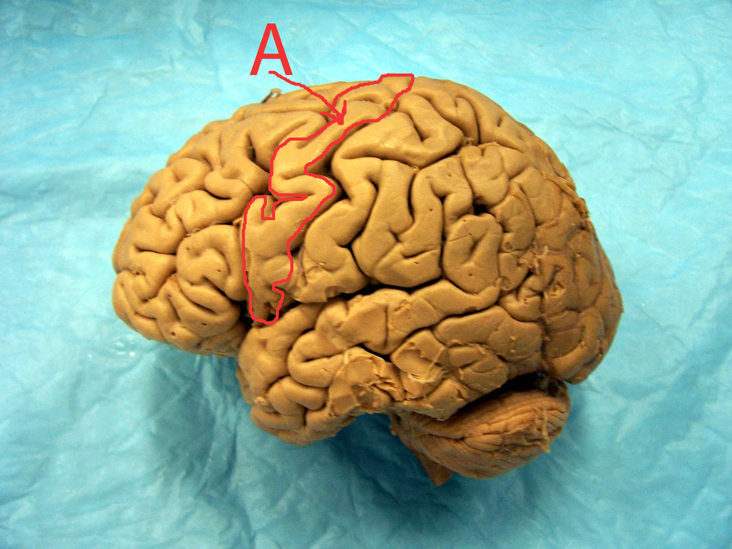 <p><span style="font-family: Lato Extended, Lato, Helvetica Neue, Helvetica, Arial, sans-serif">Identify the structure indicated by the outline, arrow, and letter "A".</span></p>