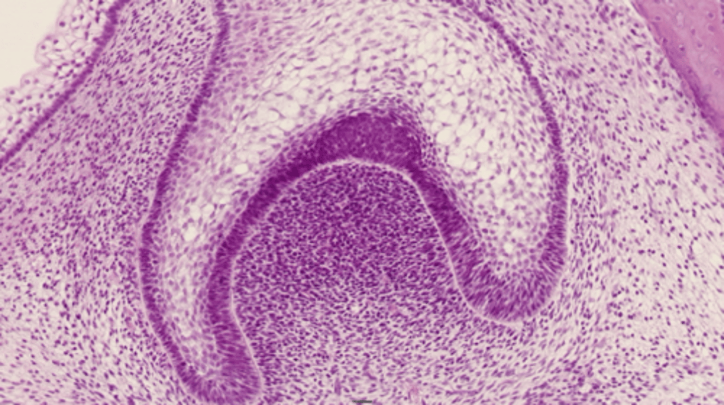 <p>Formation of a cap shape or enamal organ attached to the dental lamina</p>