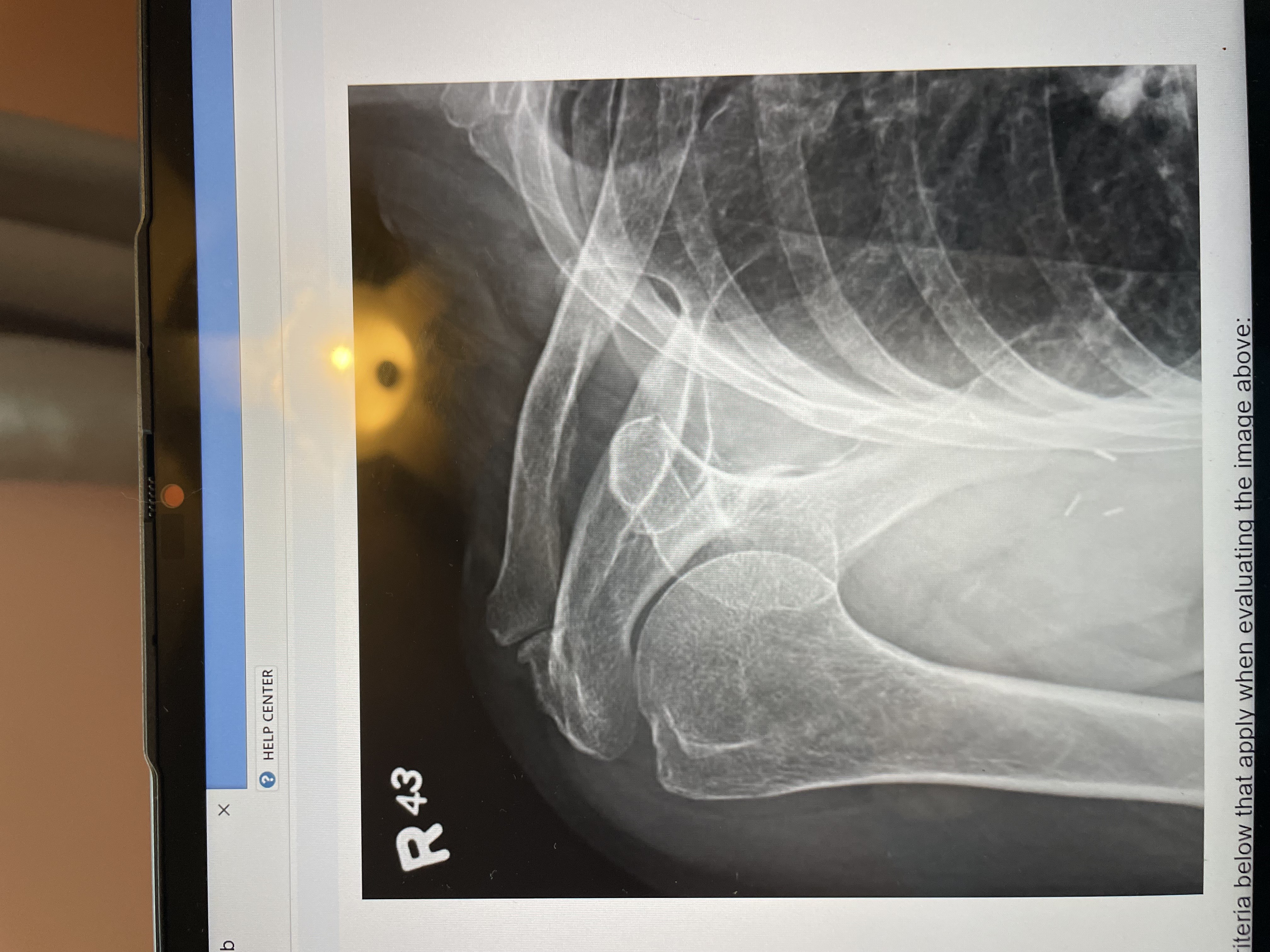<p>the entire proximal humerus, the scapula, the majority of the clavicle</p><p><em>(note this image doesnt’t have the full scapula so it wouldnt have everything required)</em></p>