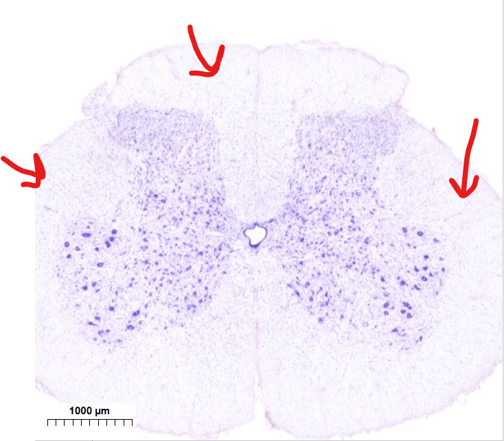 <p>(tissue type in indicated area)</p>