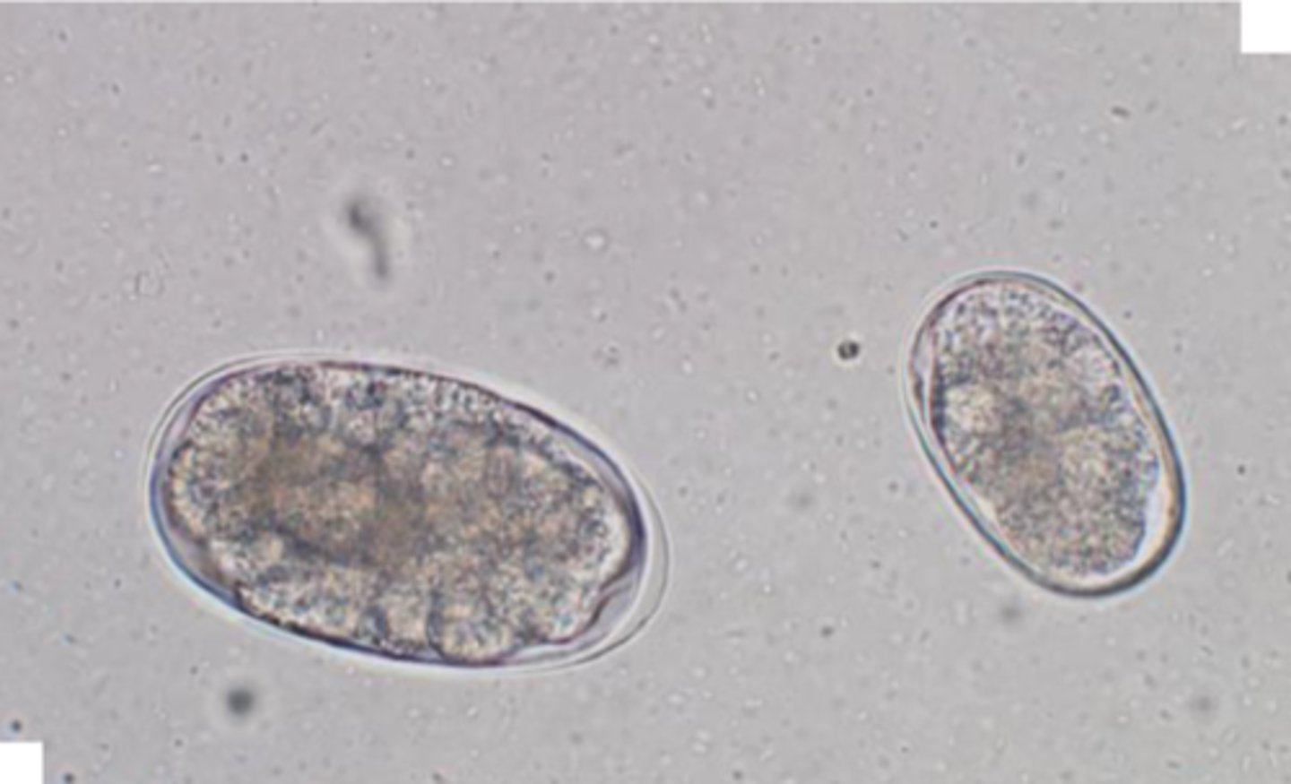 <p>Egg on the left is ____________ and the egg on the right is ____________</p>