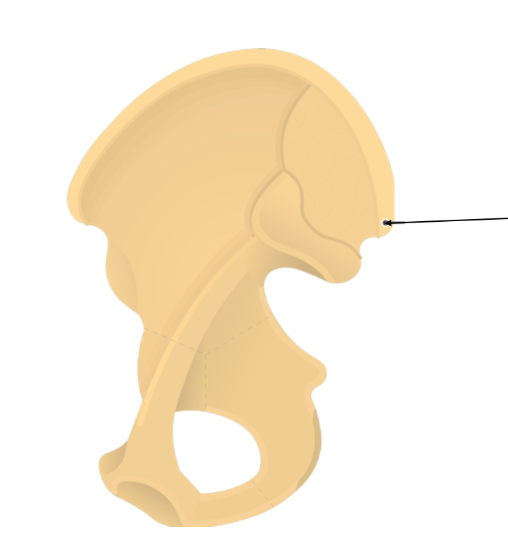 <p>What bone structure is this?</p>