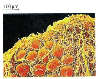 <p>Fat cells from the abdomen of a human </p>