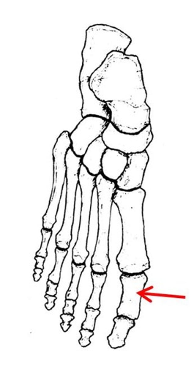 <p>ID specific bone</p>