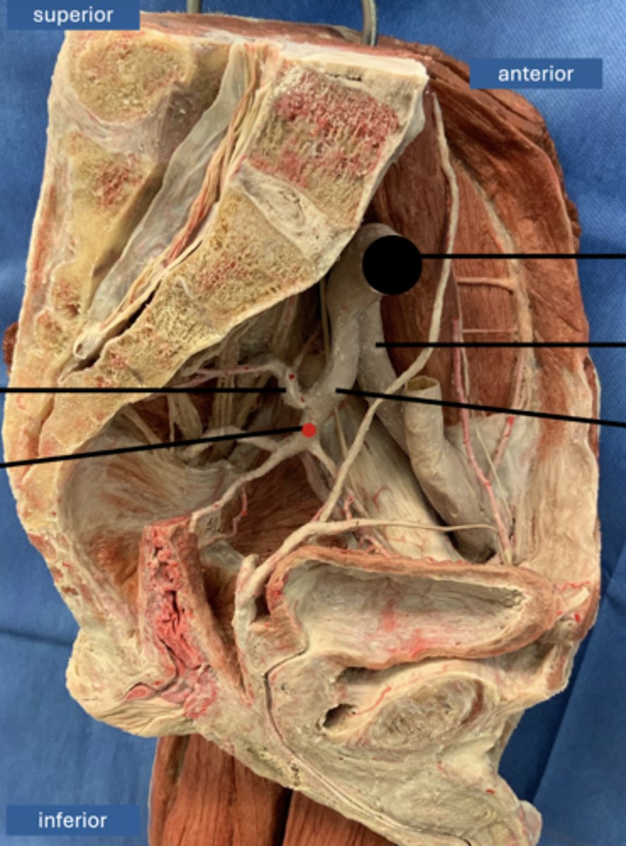 <p>artery</p>