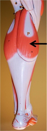 <p><span style="font-family: Arial, sans-serif">What is the origin and insertion of this muscle?</span></p>