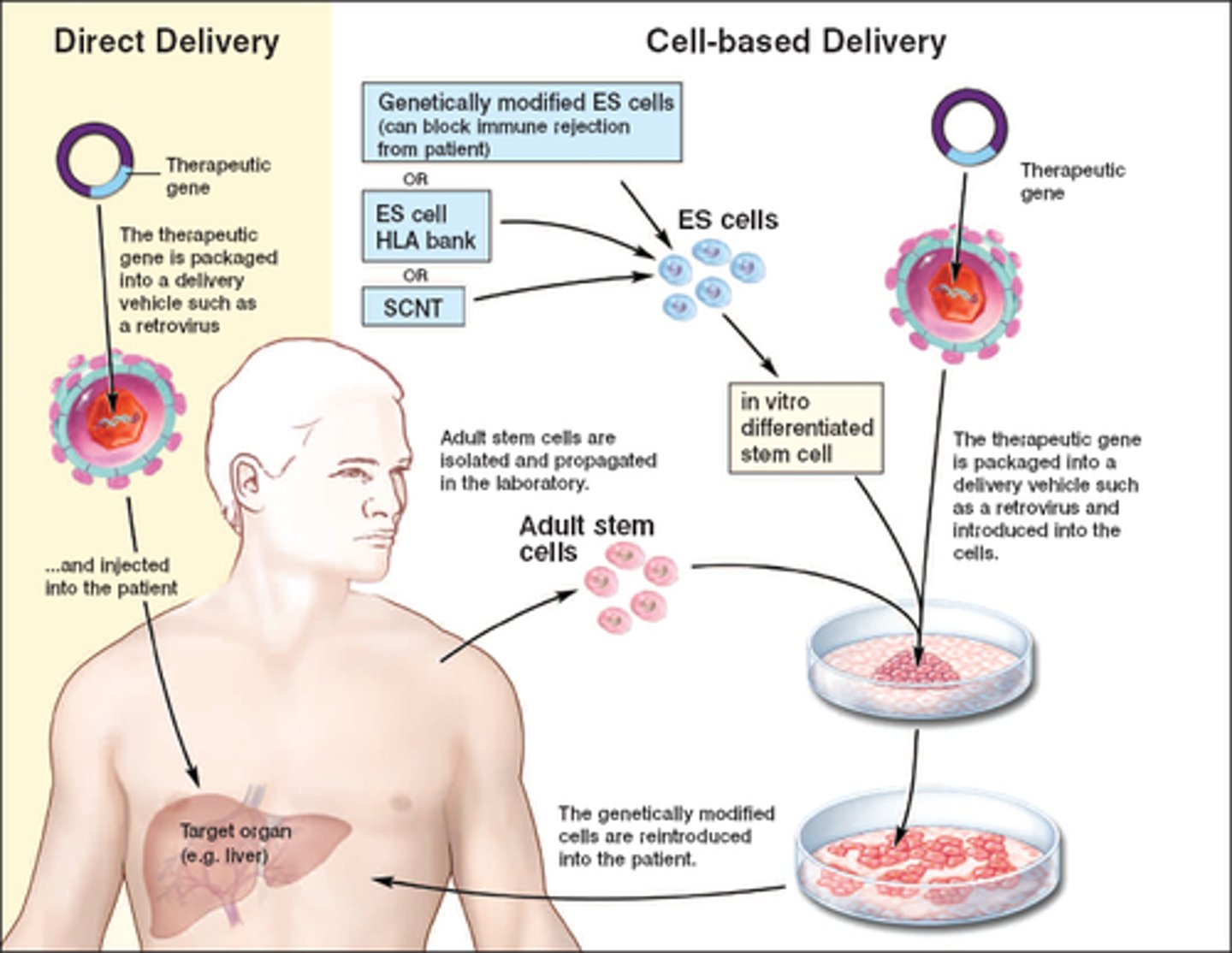 <p>Altering the alleles in body cells in order to treat a genetic disorder.</p>