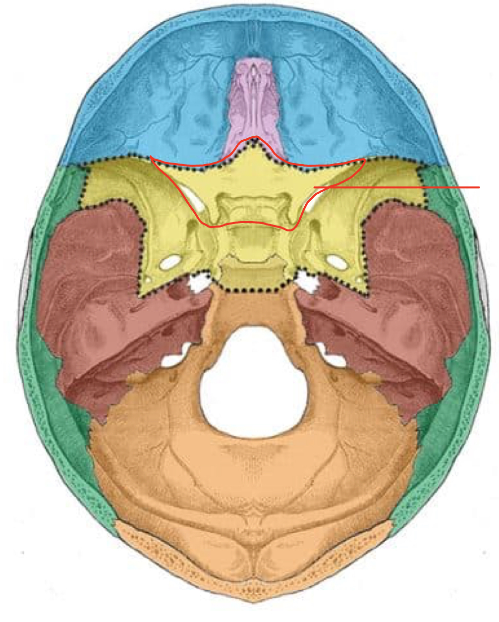 term image