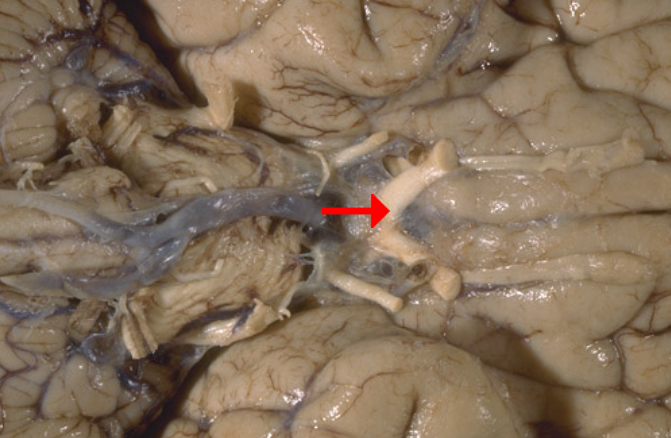 <p>Label this brain structure</p>