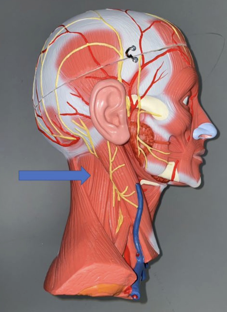 <p>muscle name & action</p>