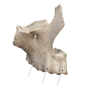 <p><span>Name the corrugated elevation <u>and the bone</u>.</span></p>