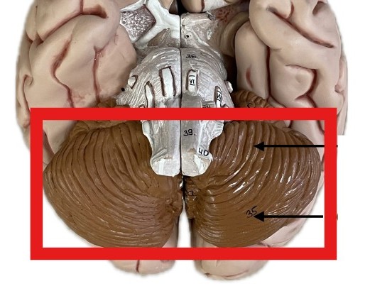 <p>Which part of the brain is:</p><ul><li><p>Brown wrinkled cauliflower-shaped</p></li><li><p>Posterior side of brain</p></li><li><p>Inferior to occipital lobe</p></li></ul><p></p>