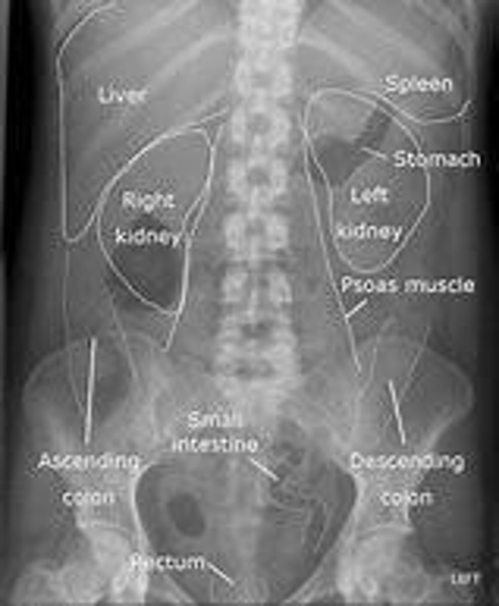 <p>Kidneys, Ureters, Bladder</p>