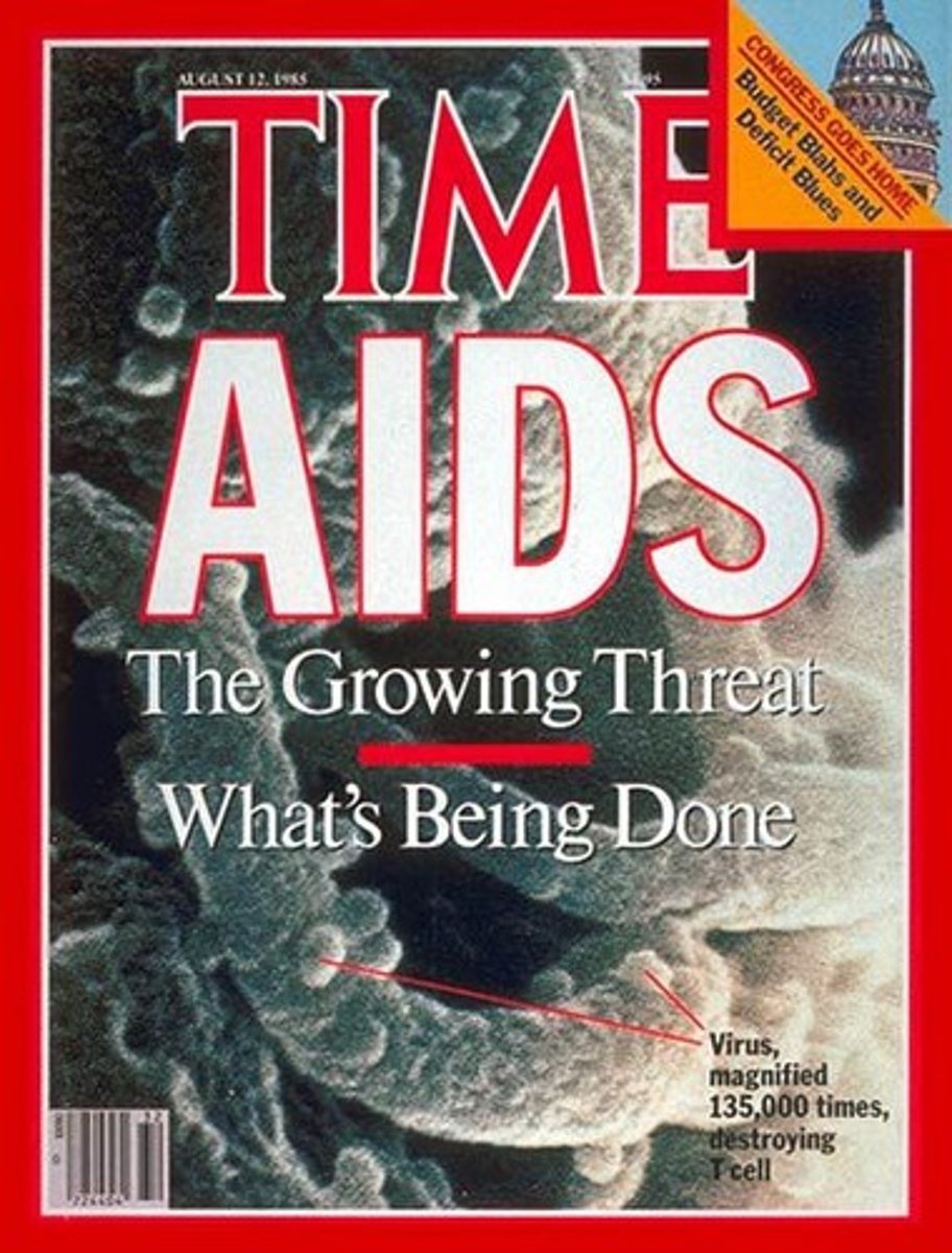 <p>Disease caused by a virus that attacks the immune system. The public first became aware of its existence in the early 1980's. The world-wide death toll since then is 35 million.</p>