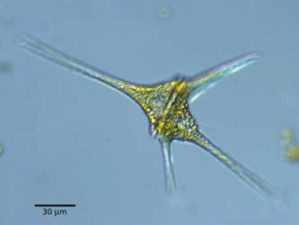 <p>What is this organism?</p>