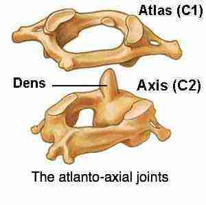 * between the Atlas bone and the axis bone