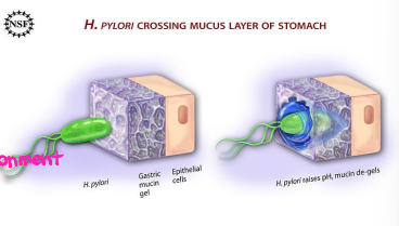 <p><strong>H.pylori: Pathogenic/Virulence Factors</strong></p><p>-Bacterial ______ hydrolyzes gastric luminal urea to form ________, which __________ gastric acid and forms __________ cloud around organism. This enables ____________ of gastric mucus layer </p><p>-Spiral shape, flagella, and mucolytic enzymes produced facilitate passage through mucus layer to gastric __________</p><ul><li><p>Attaches to gastric epithelial cells by specific receptor mediated ________</p></li></ul><p>-Release ___________ and chemokines, which promotes gastric epithelial cell ____________</p><ul><li><p>Results in atrophy, ulcers, cell proliferation/dysplasia/cancer</p></li></ul><p></p>