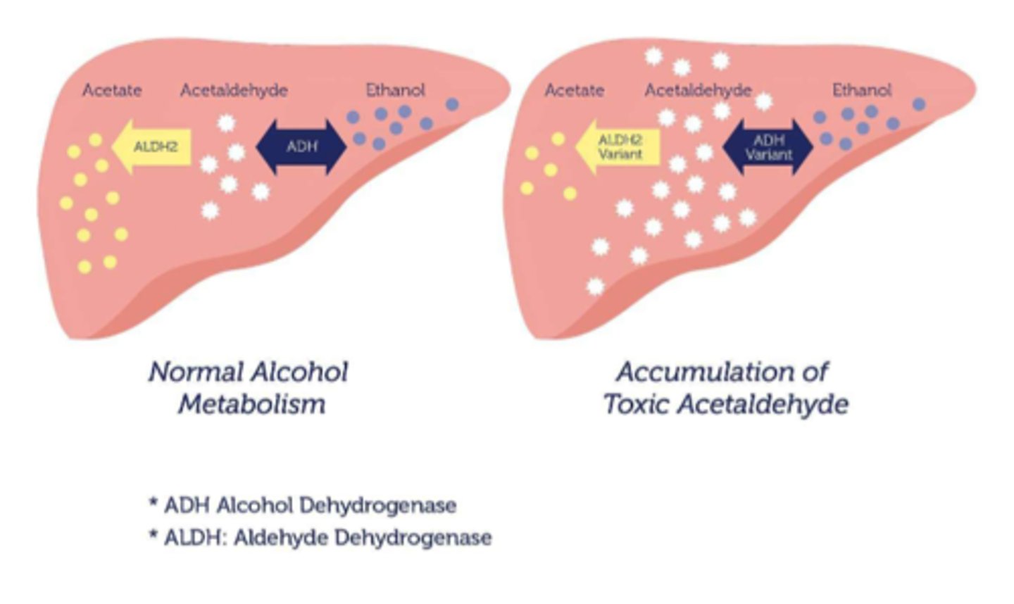 <p>- when the body cannot metabolize acetaldehyde, resulting in toxic accumulation of it</p><p>- increased acetaldehyde inhibits ADH, causing diuresis which in chronic use can result in dehydration &amp; electrolyte imbalances</p>