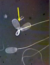 <p>Identify the sperm morphology.</p>