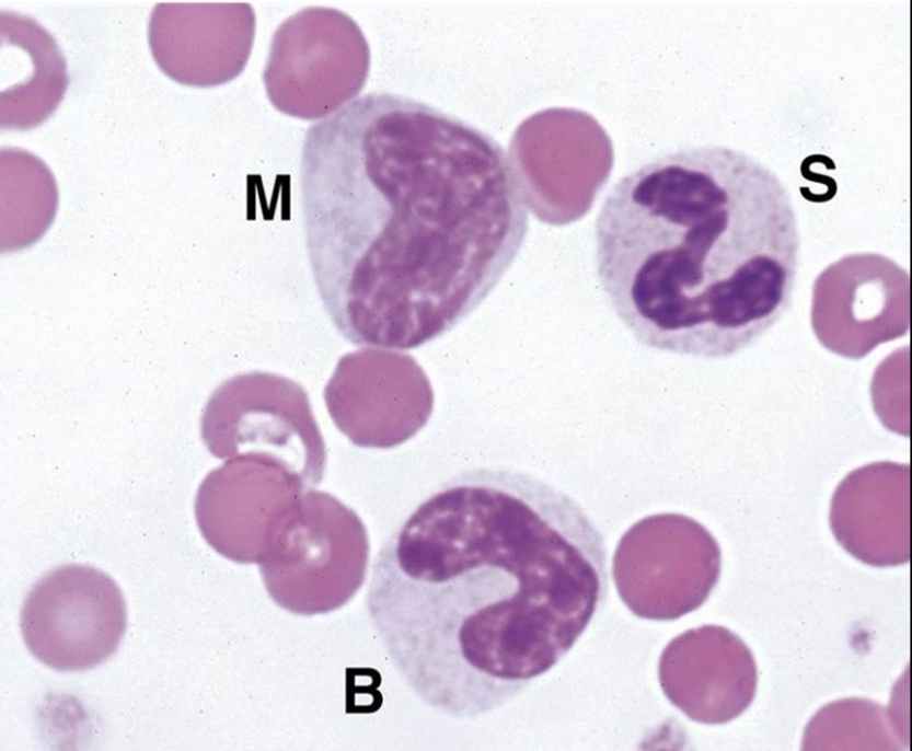 The 3 cells below were found in circulation and all were identified as neutrophils at different stages of maturation. When this is seen, a ____  _____ is said to be present.