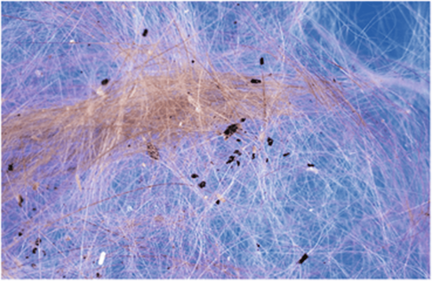 <p>Finding "dirt" in the hair coat of a dog or cat is indicative of:</p>