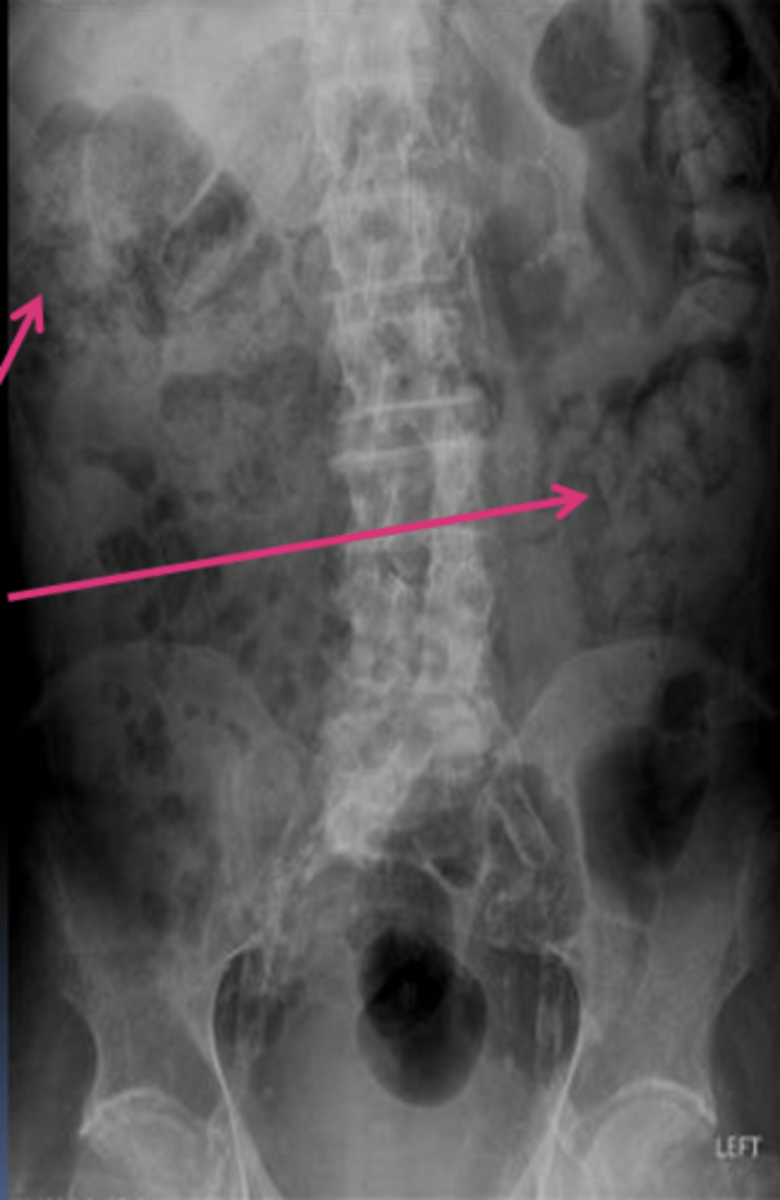 <p>What are the arrows pointing to?</p>