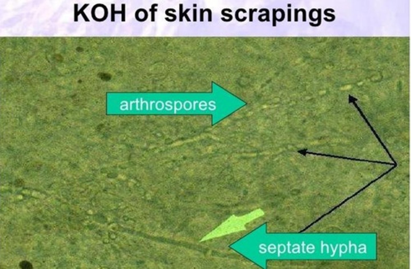 <p>It clears specimens to demonstrate ringworm arthrospores surrounding infected hairs.</p>