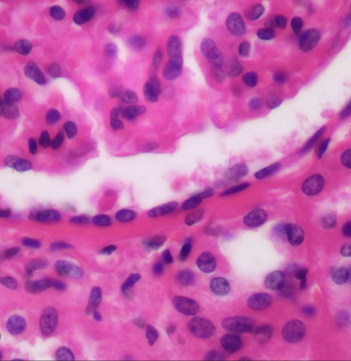 <p>Permits rapid diffusion and filtration; secretes lubricating serous fluid — Alveoli of lungs, capillary endothelium, Bowman's capsule of kidney</p>