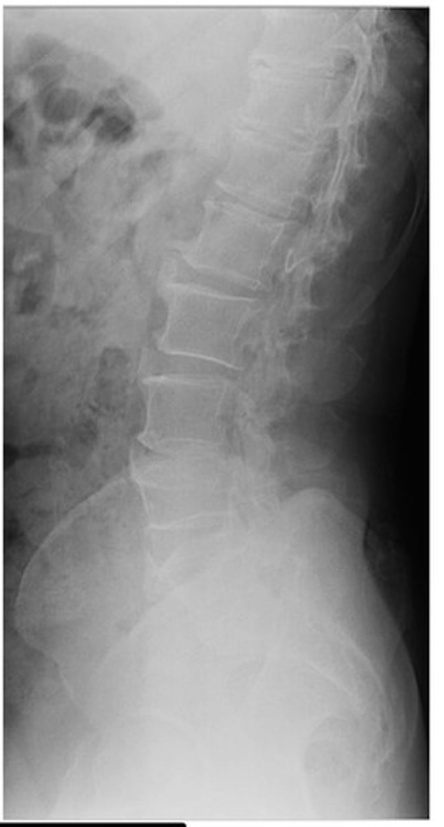 <p>What diagnosis is this?</p>