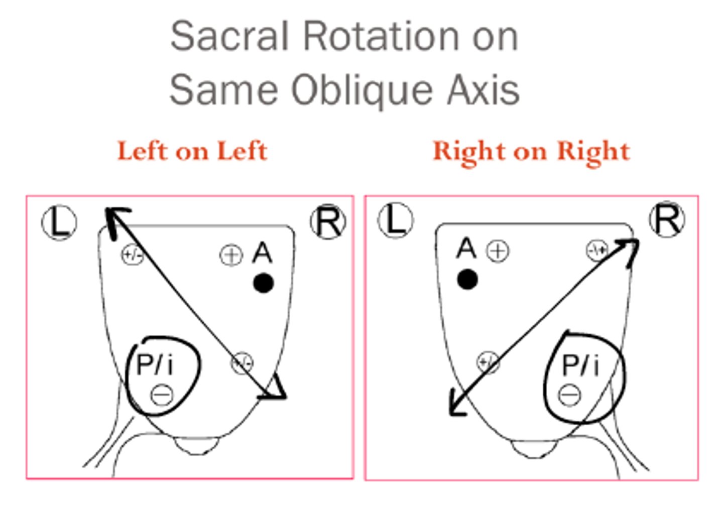 <p>For a forward sacral rotation, the rotation and axis direction are the ___________.</p>