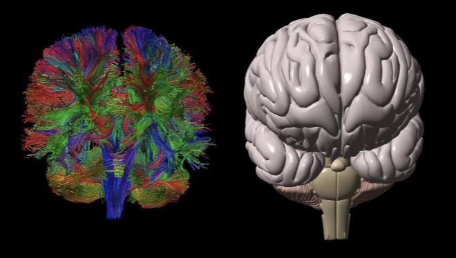 <p>-DTI-derived <span>quantitative measure of the directional dependence of water diffusion</span></p><p><span>-reflects anatomical features of white matter, such as axon caliber, fiber density, and myelination</span></p>