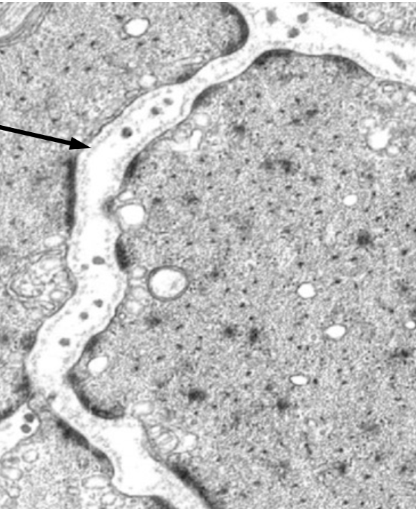 <p>what cell is this and what is the arrow pointing to</p>